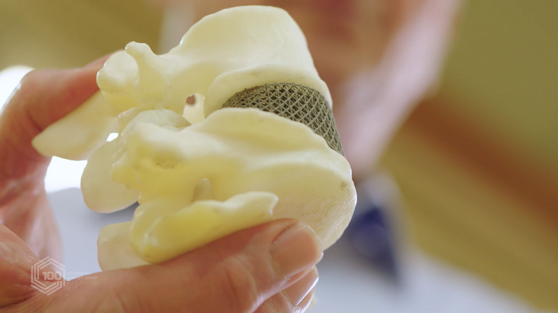 Trung tâm Chế tác công nghệ cao Đại học RMIT in thành công đĩa đệm cột sống 3D